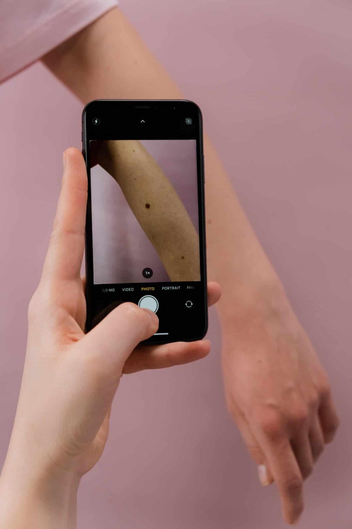 Uno strumento Google per aiutare a identificare le malattie della pelle - 