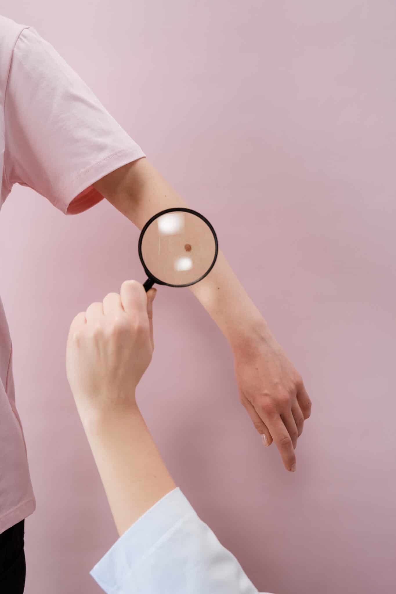L'obiettivo dello strumenti di AI non è quello di sostituirsi al medico, ma di fornire informazioni autorevoli sulle condizioni della pelle.