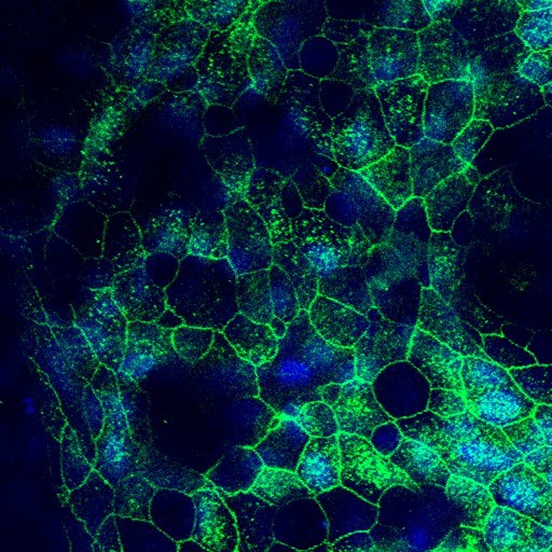 In verde, la proteina del recettore ACE2 espressa nelle cellule polmonari coltivate nel chip. Credits: Wyss Institute at Harvard University