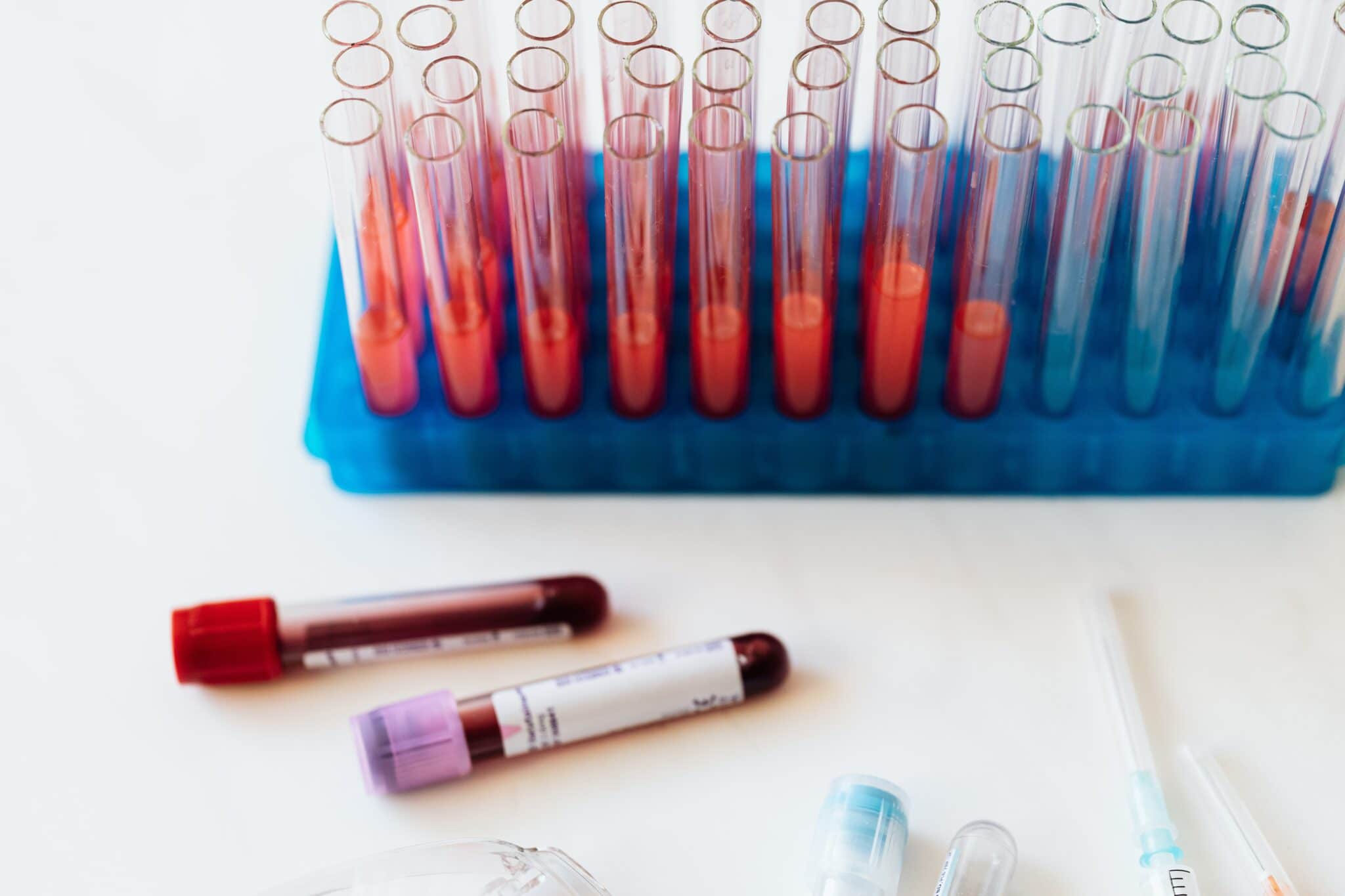 analisi del sangue