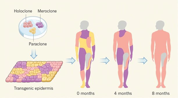 Credits: Advances on potential therapeutic options for epidermolysis bullosa/ Michele De Luca