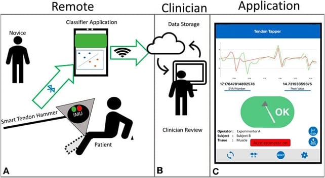 Il sistema del martello intelligente. Credits: A Smart Tendon Hammer System for Remote Neurological Examination