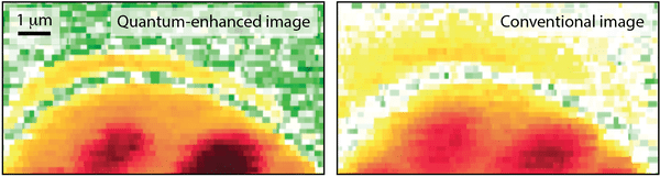 Differenza di immagine tra microscopio quantistico e convenzionale. Credits: Warwick Bowen