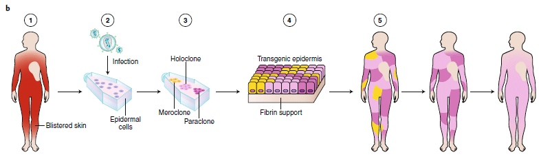 Credits: Advances on potential therapeutic options for epidermolysis bullosa/ Michele De Luca
