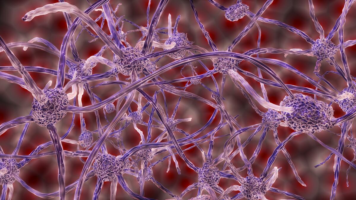 Neuroblastoma: nuove prospettive terapeutiche per uccidere le cellule tumorali - Il neuroblastoma è un cancro infantile devastante.