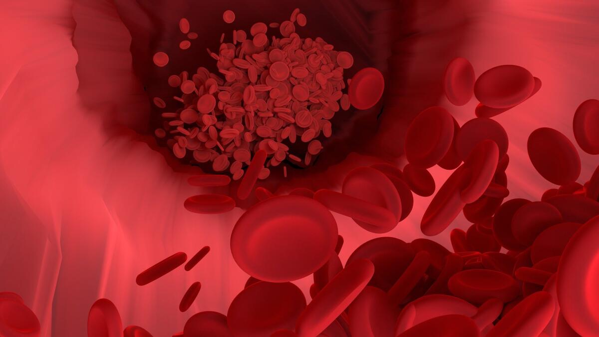 Un cerotto innovativo per monitorare problemi cardiovascolari - 