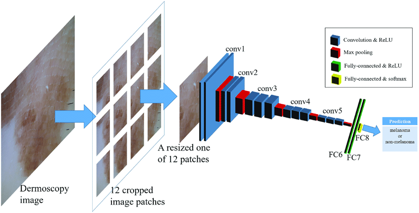 Panoramica schematica dell'architettura CNN: il numero di classi di output è stato impostato su 2 (classi melanoma e non melanoma) per le immagini dermoscopiche. Credits: Plos One, "Acral melanoma detection using a convolutional neural network for dermosc