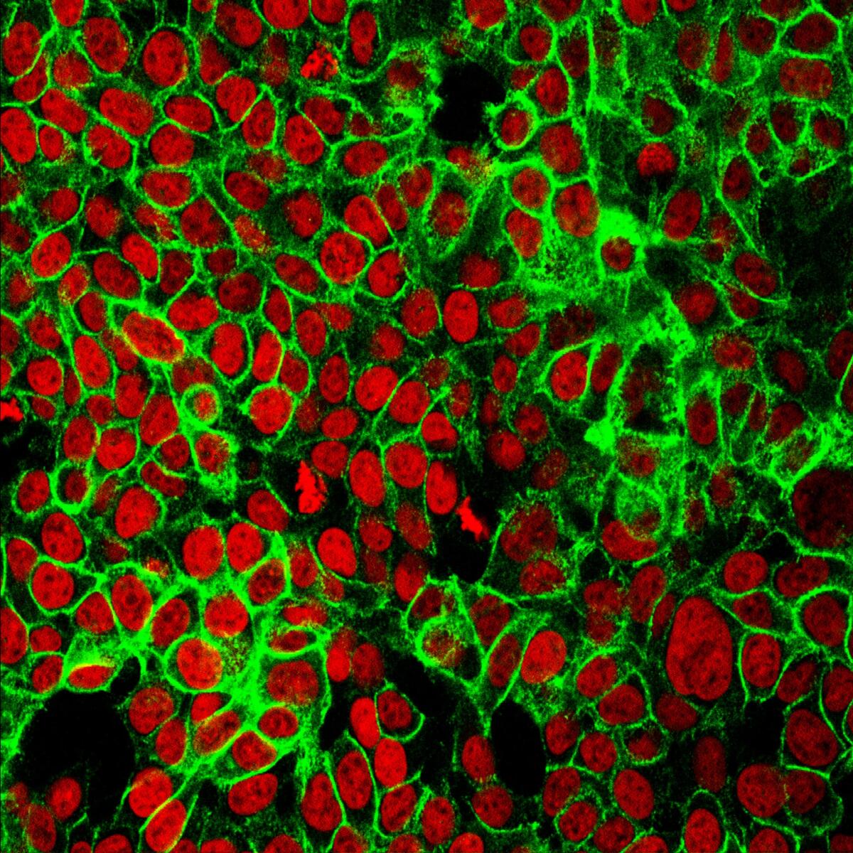 Un test non invasivo rileva le cellule del cancro e ne individua la posizione - Cellule di cancro del colon. Credits: NCI Center for Cancer Research