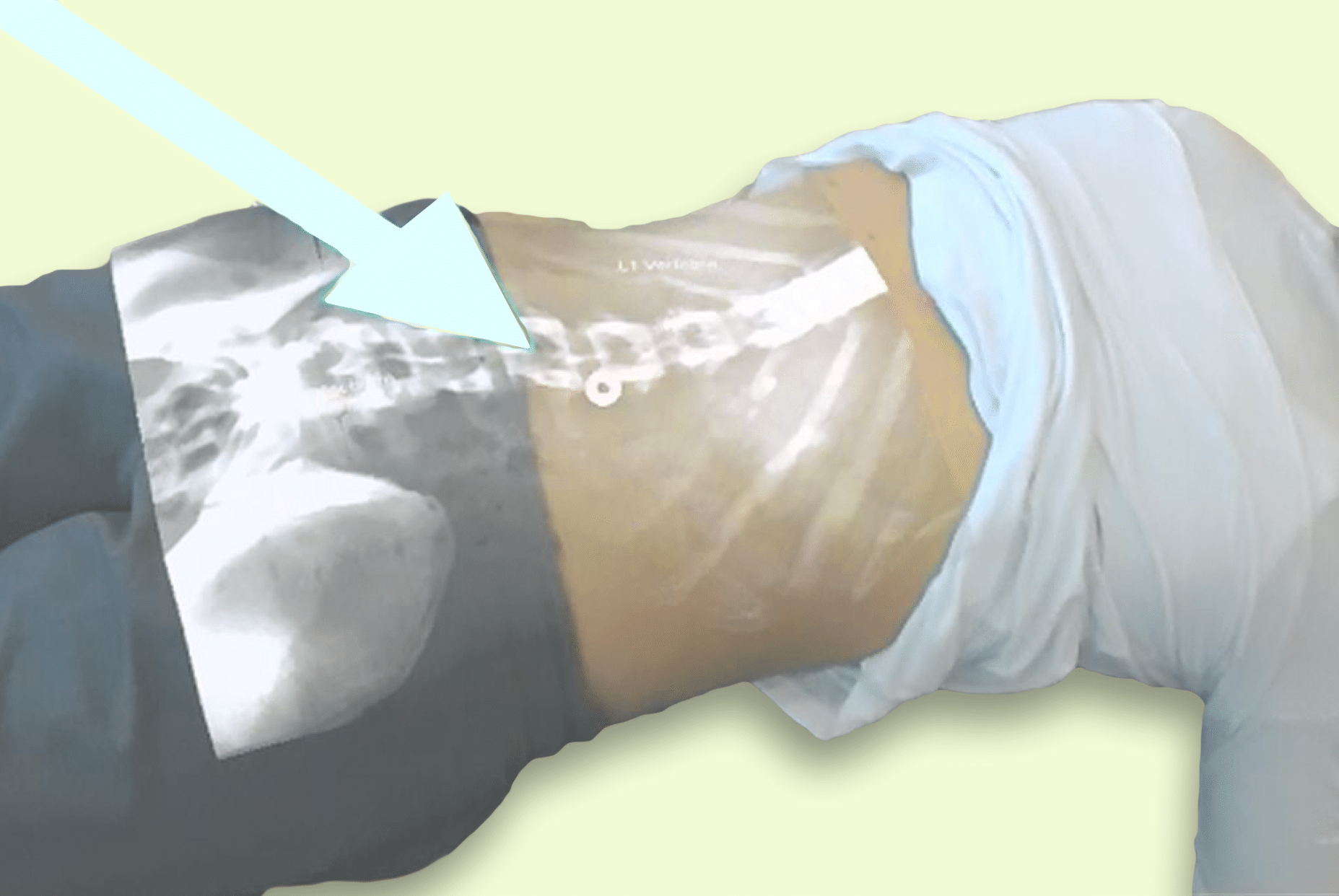 Esempio di funzionamento della piattaforma AR ProjectDR. Credits: University of Alberta