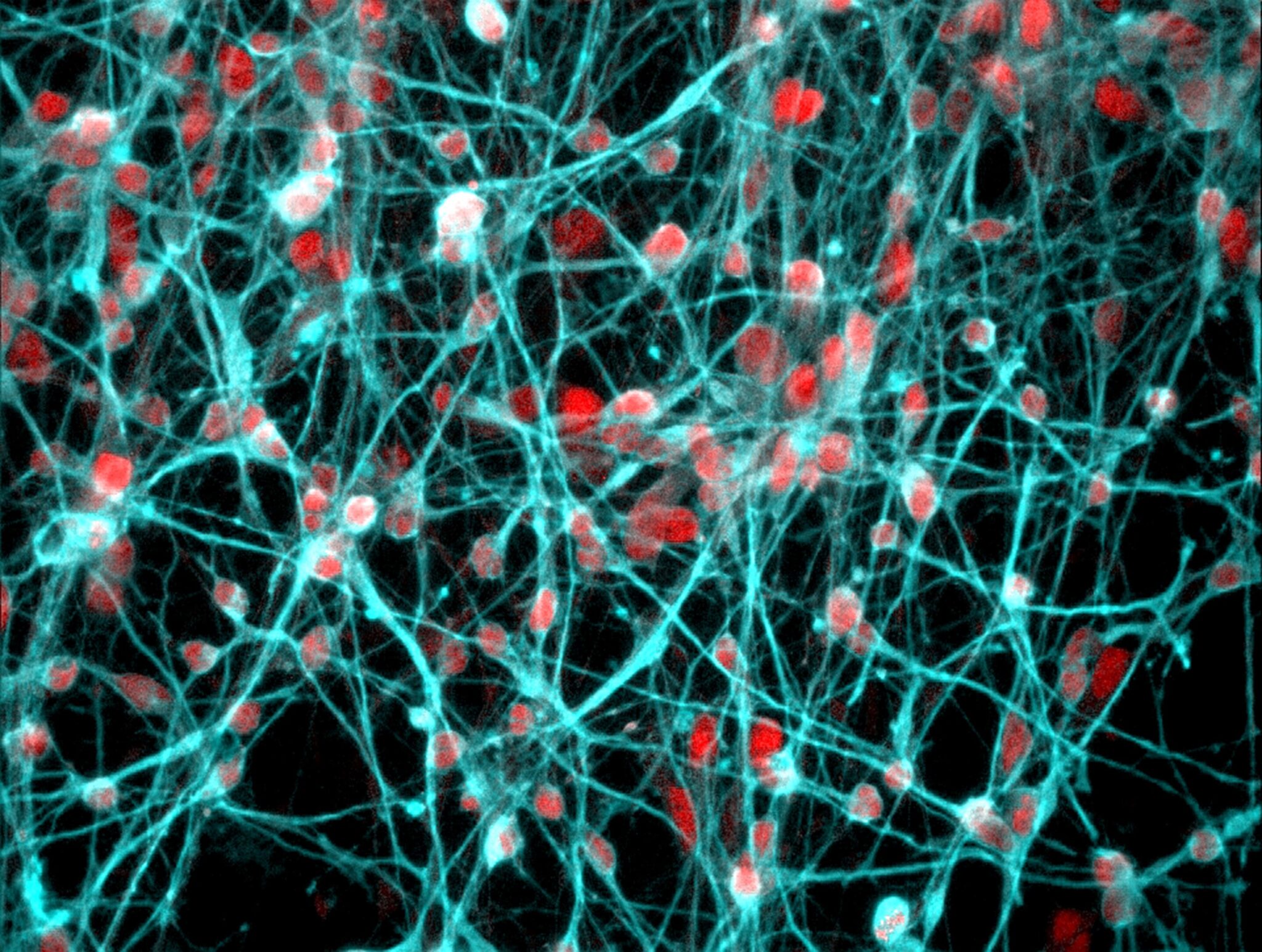 Un'immagine ingrandita dello sviluppo di giovani neuroni umani. Il recettore dei mineralcorticoidi (MR), di colore rosso, è stato trovato nel nucleo cellulare di questi neuroni. Credits: University of Bristol