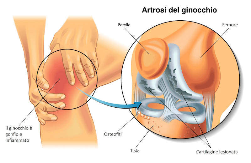 Credits: Salvati Diagnostica