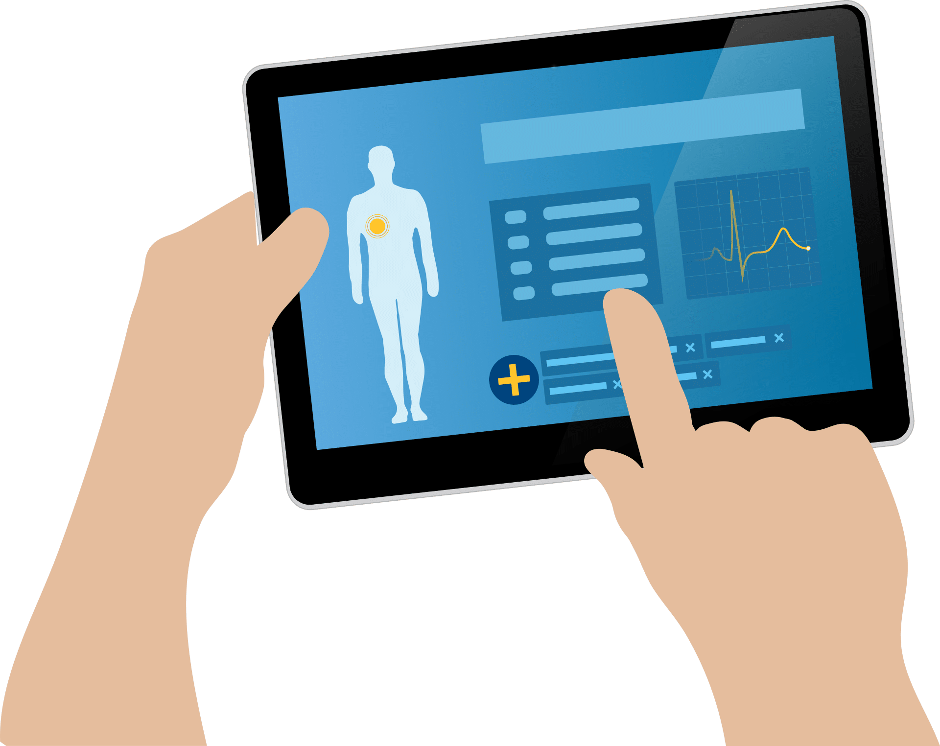App per diagnosticare Alzheimer