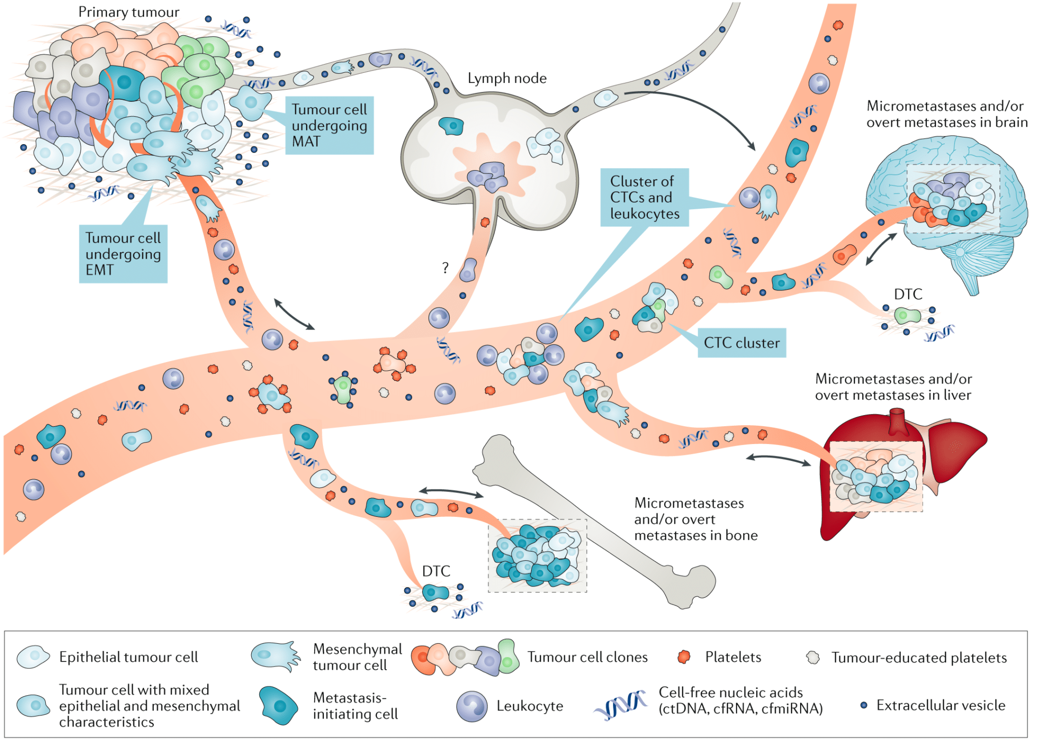 Biologia della diffusione di un tumore all'interno del flusso sanguigno. Keller, L., & Pantel, K. (2019). Unravelling tumour heterogeneity by single-cell profiling of circulating tumour cells. Nature Reviews Cancer, 19(10), 553-567.