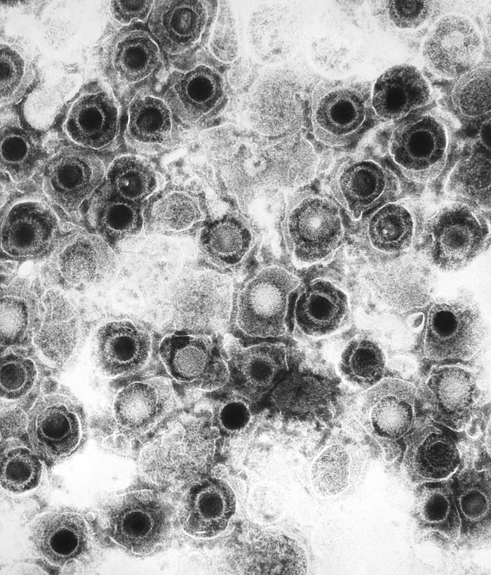 Herpes simplex virus. Credits: CDC/Dottor Fred Murphy