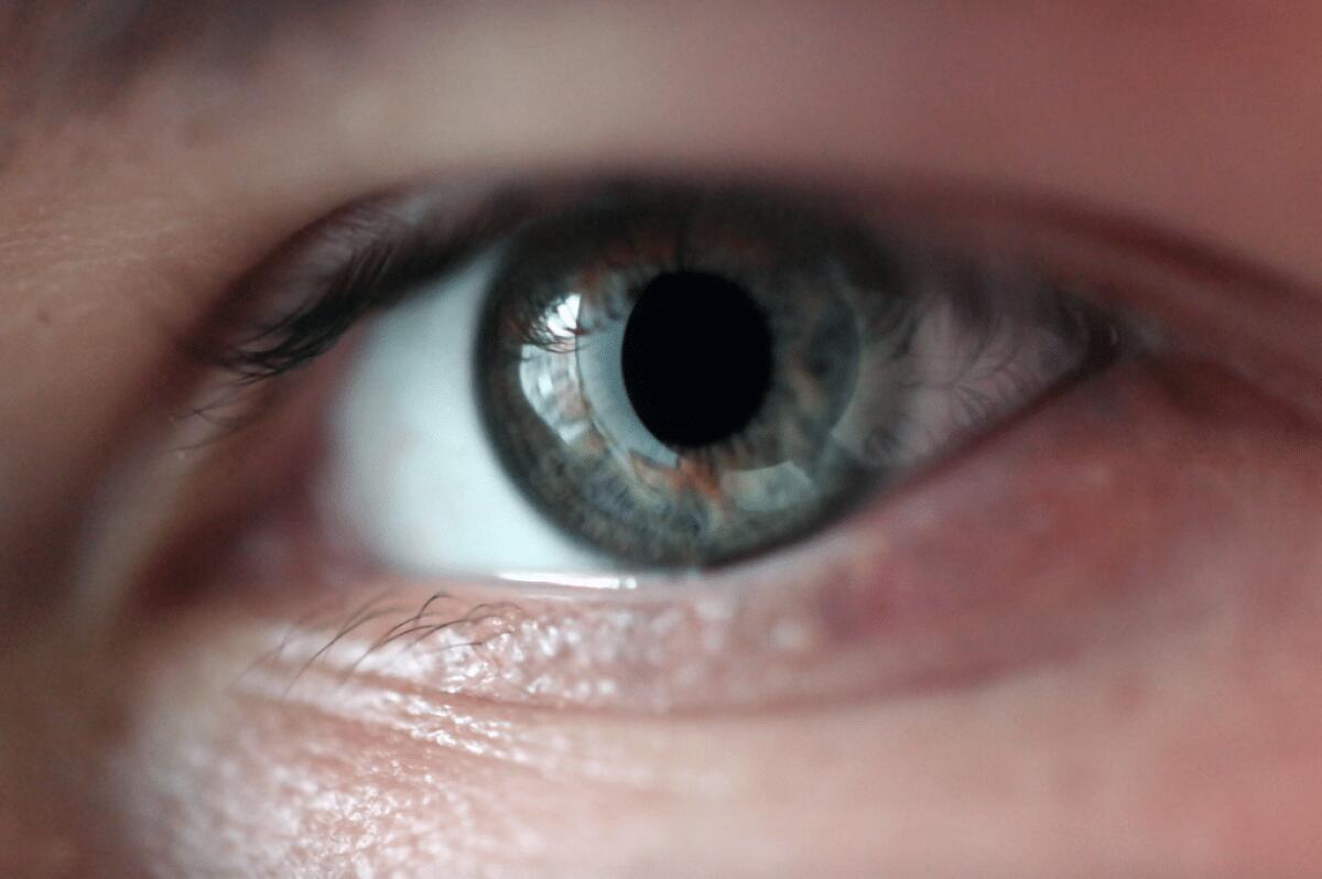 Difetti visivi più comuni, motivi e curiosità - 