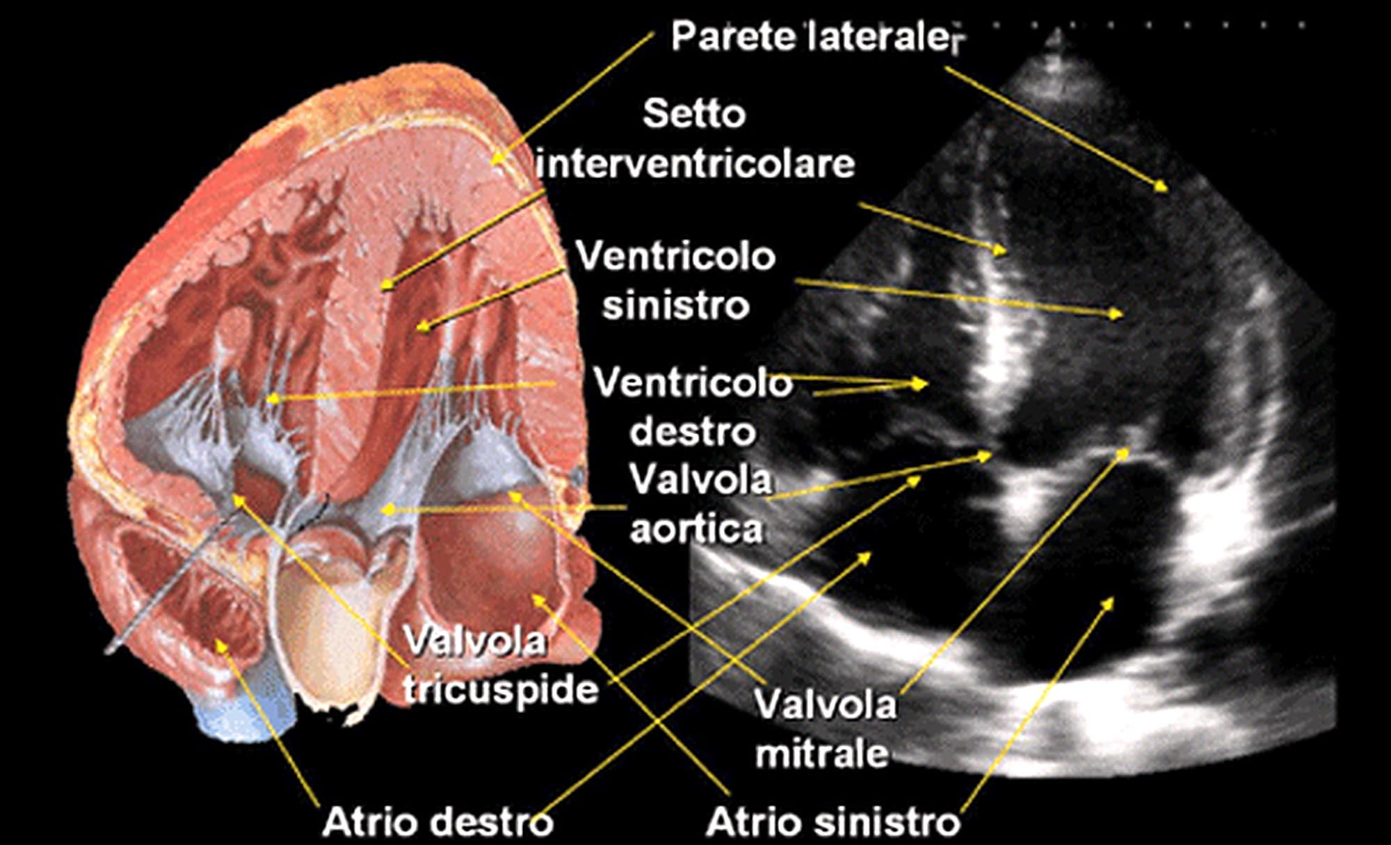 Ecocolordoppler cardiaco (ecocardio). Credits: Medicina online