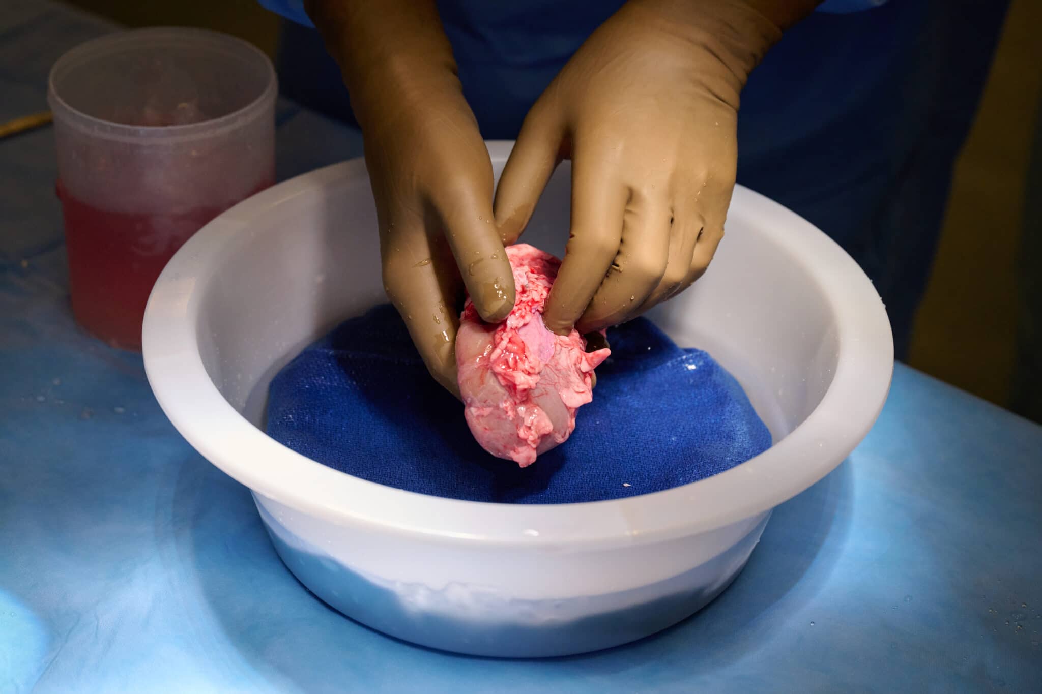 Un rene di maiale geneticamente modificato viene pulito e preparato per il trapianto in un essere umano. Credits: Joe Carrotta per NYU Langone Health