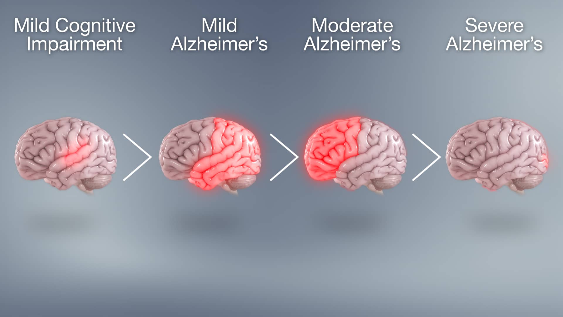 Fastball punta ad una diagnosi ancor prima del declino cognitivo. Crediti:scientificanimation.com