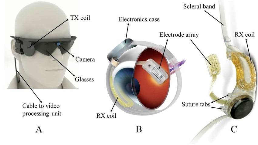 Schema di Argus II. Crediti: Kush Agarwal.