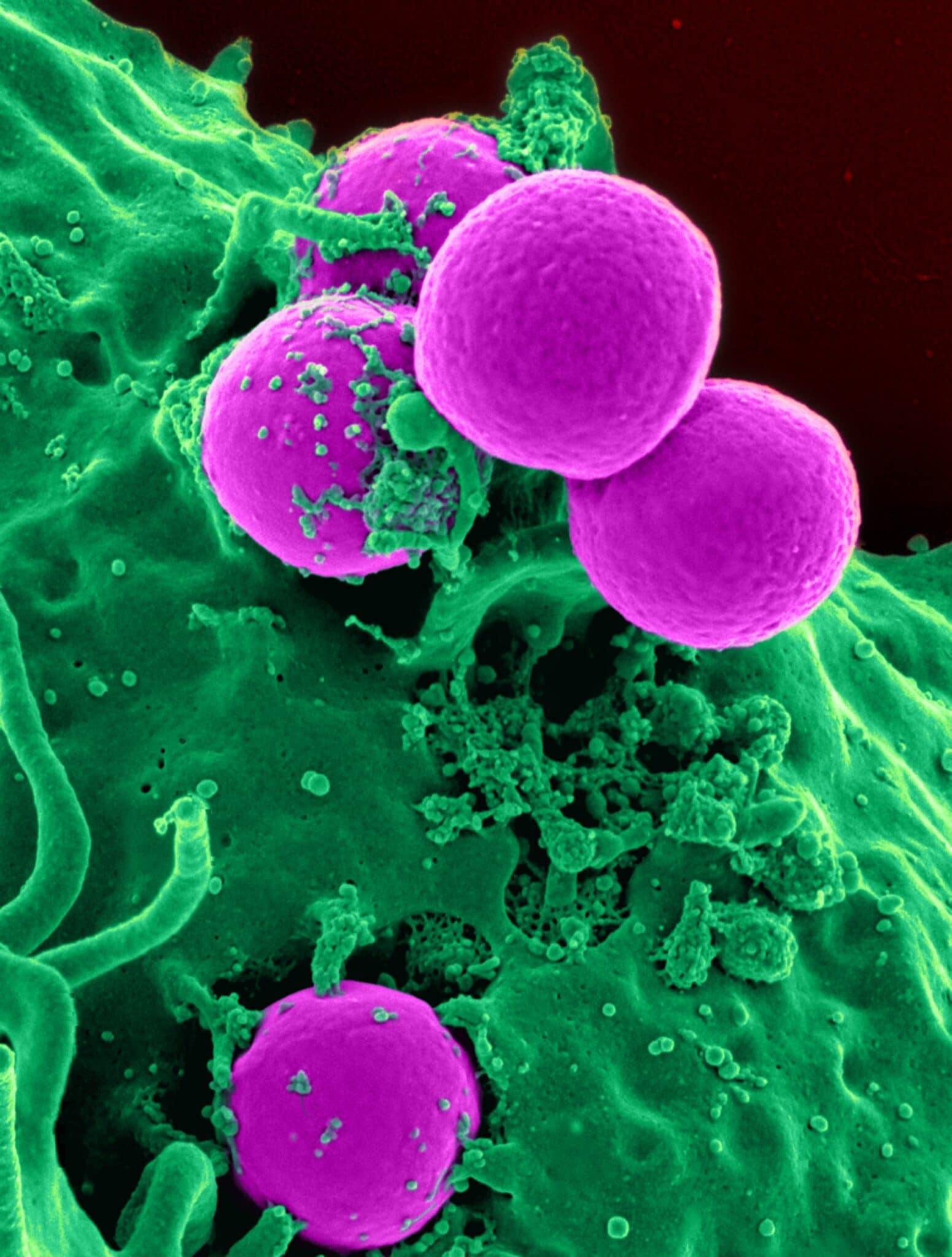 nanoparticelle tumori