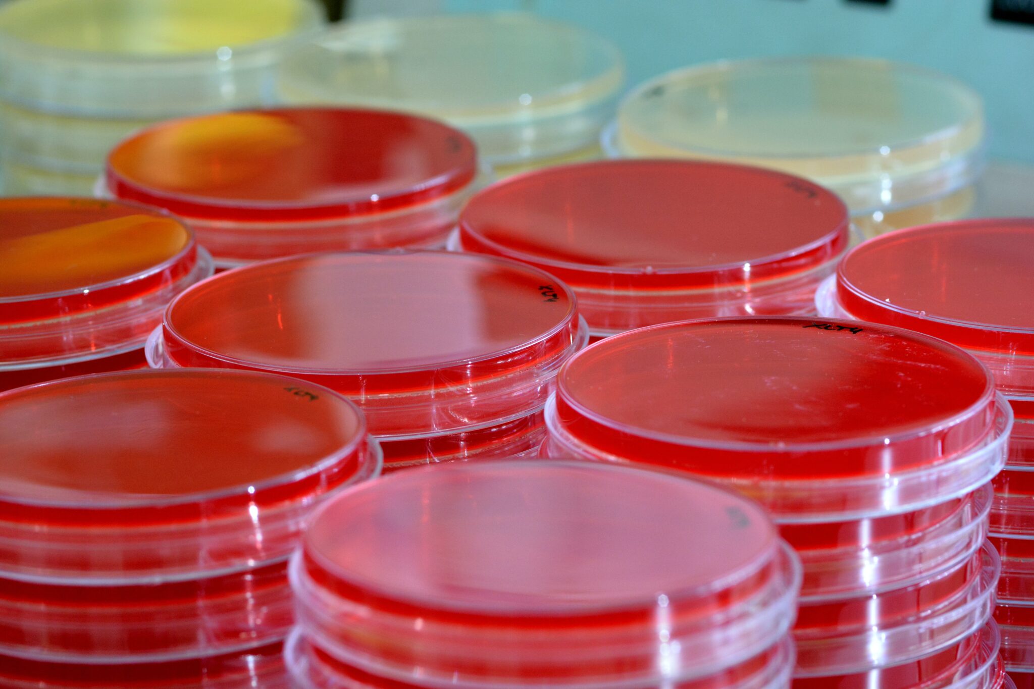 Candida auris: aumento del numero delle infezioni nei pazienti affetti da COVID-19