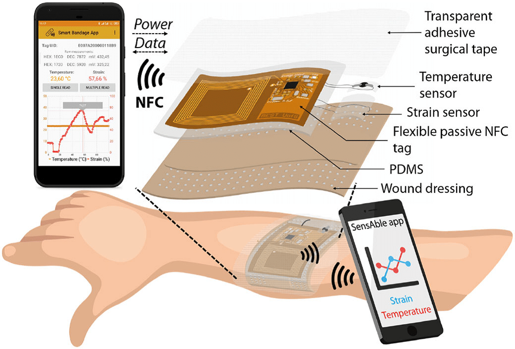Schema di funzionamento del bendaggio intelligente. Crediti: P. Escobedo et al. (2021). Smart bandage with wireless strain and temperature sensors and batteryless NFC tag. IEEE INTERNET OF THINGS JOURNAL, vol. 8, no 6.