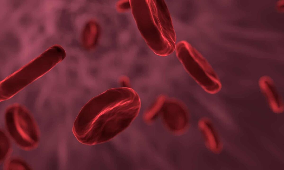 Aterosclerosi: la malattia dei vasi sanguigni - 