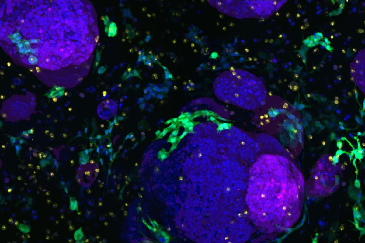 Il diabete e gli organoidi pancreatici: un nuovo contatto alla terapia metabolica - Credits: mit.edu