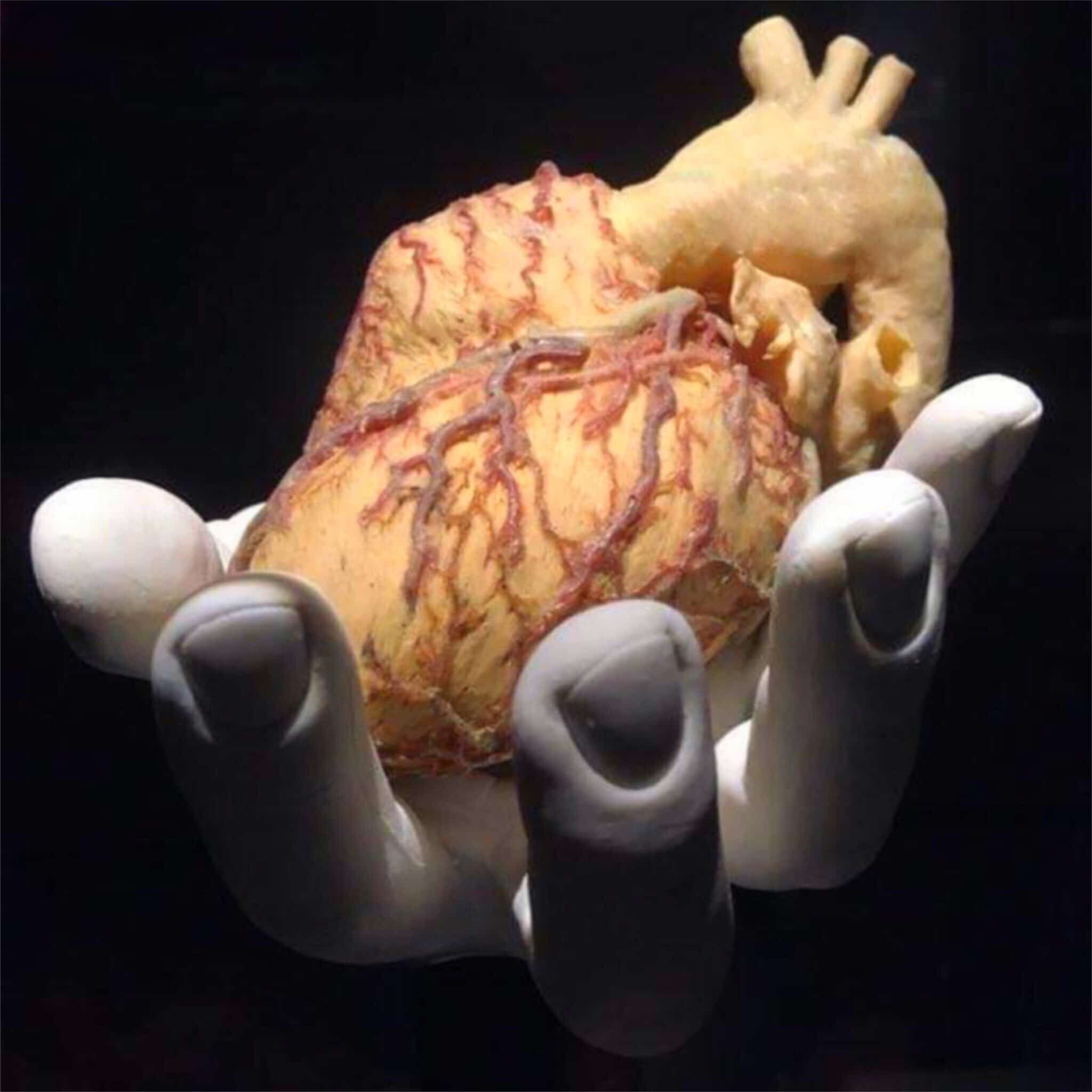 Cuore di suino geneticamente modificato