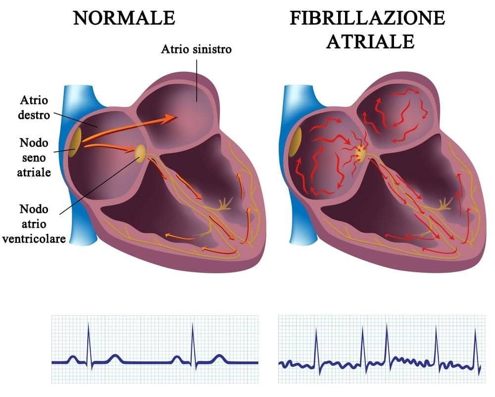 Credits: Cardiologia UMG Catanzaro