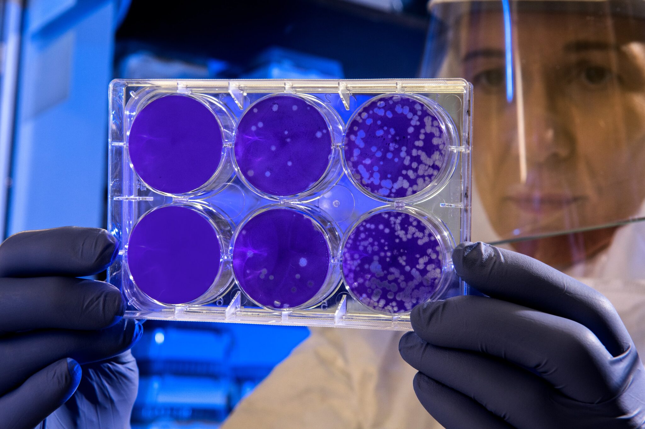 Trattamento della lesione spinale: il Giappone utilizza per primo le iPS\