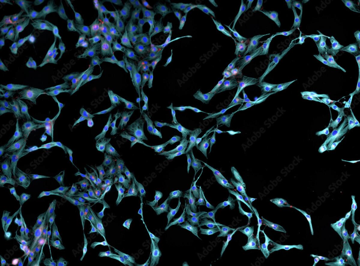 Un nuovo modello per trattare la fibrosi senza l’utilizzo degli animali - 