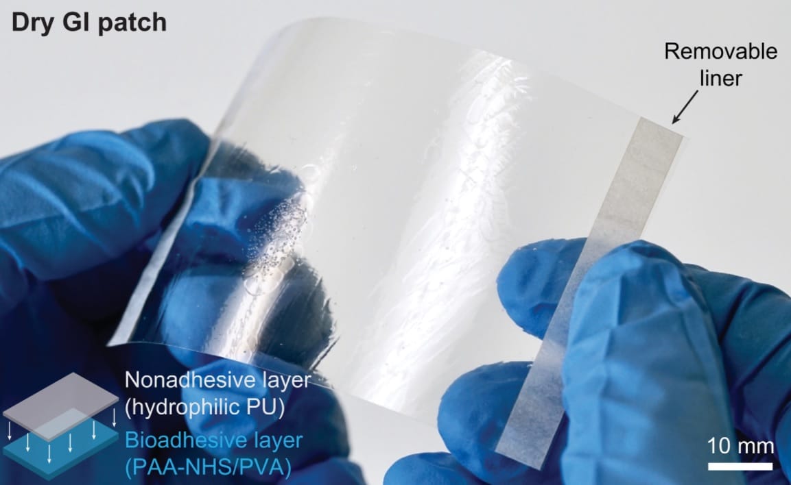 Fotografia del cerotto gastrointestinale a secco e un'illustrazione schematica (in basso a sinistra) per la sua struttura, costituita dallo strato superiore non adesivo a base di PU idrofilo e dallo strato inferiore bioadesivo a base di PAA-NHS e PVA. Cre