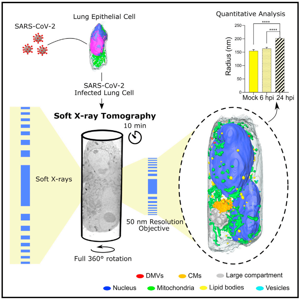 Pipeline dello studio effettuato dal COS di Heidelberg. Crediti: "Using soft X-ray tomography for rapid whole-cell quantitative imaging of SARS-CoV-2-infected cells" - Cell Reports