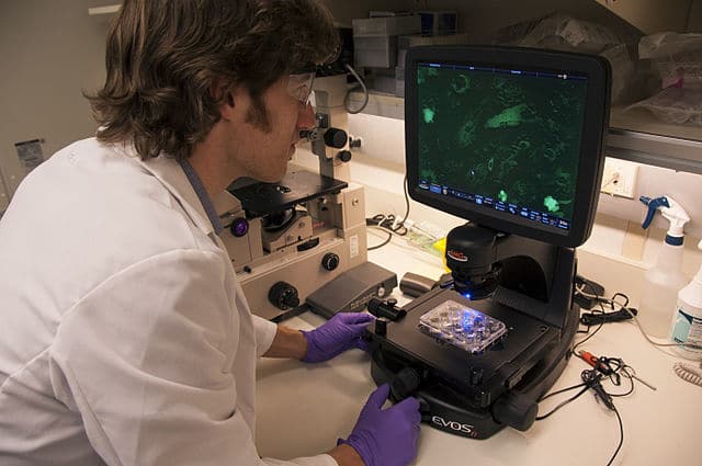 Anemia falciforme: scoperta una possibile una cura?