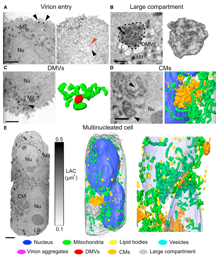 Studio dell'infezione da SARS-CoV-2 e dei suoi effetti su una cellula. Crediti: "Using soft X-ray tomography for rapid whole-cell quantitative imaging of SARS-CoV-2-infected cells" - Cell Reports