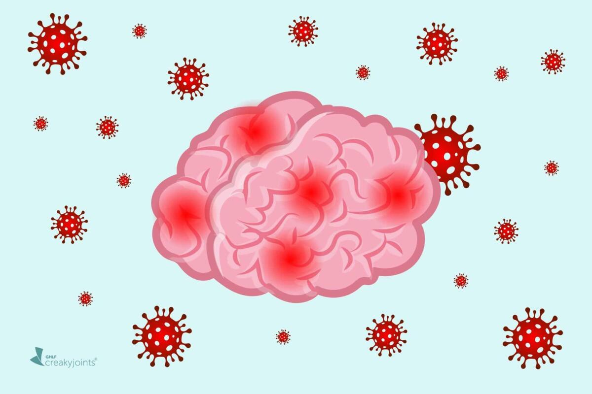 COVID-19 e alterazioni sul cervello: un nuovo studio - 
