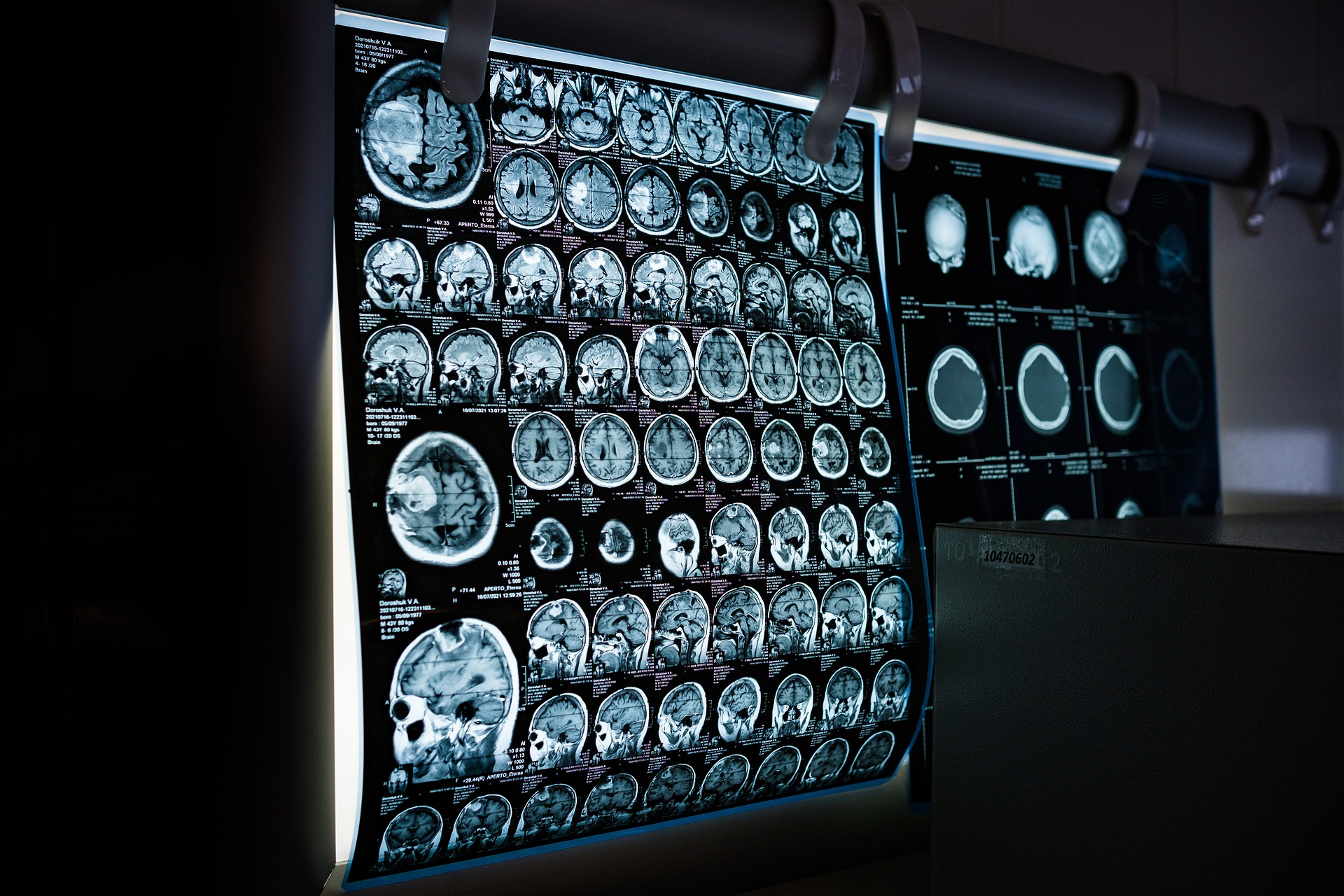 Effetti piombo sul cervello