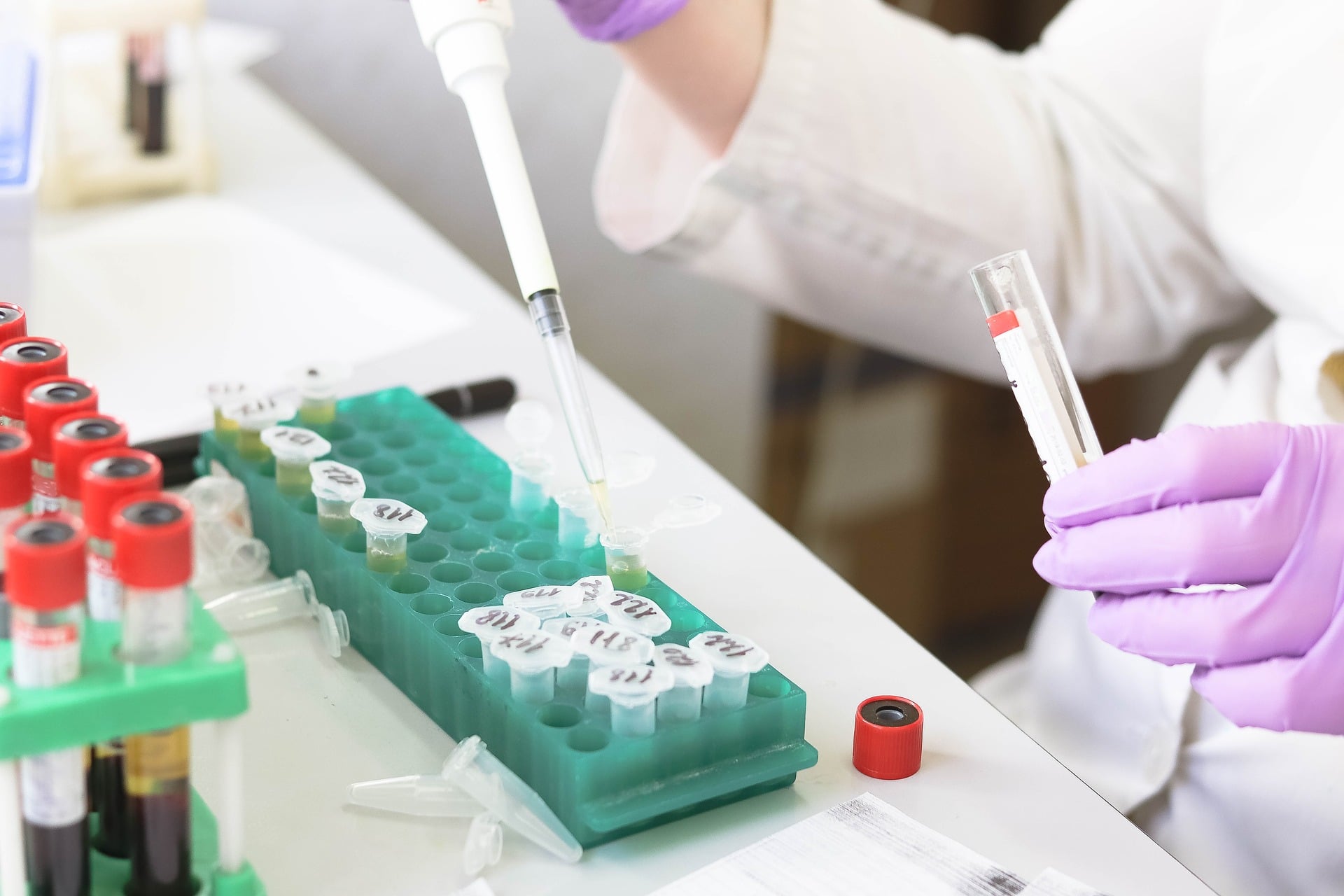 HPV e tumore orofaringeo: un esame del sangue può predire una recidiva