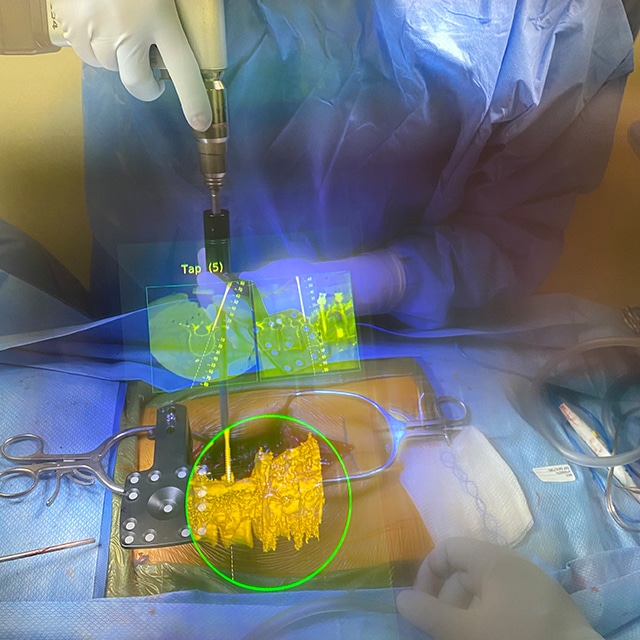 Immagine ottenuta dal primo intervento di AR a Baltimora - Credits:  Hopkins Medicine