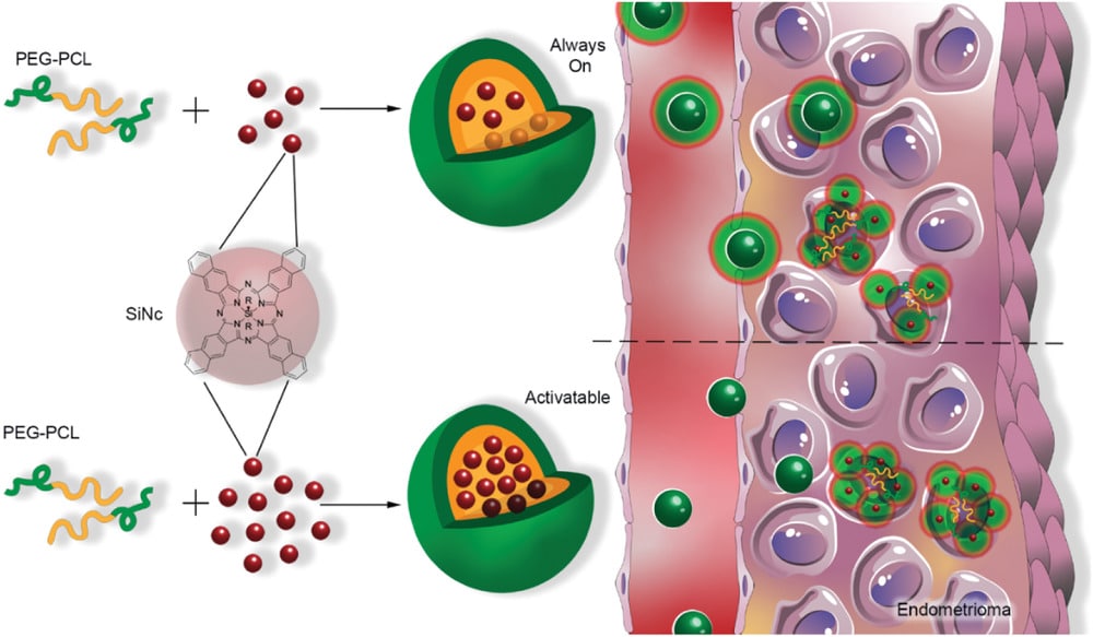 Credits: Moses, Abraham S., et al. "Nanoparticle‐Based Platform for Activatable Fluorescence Imaging and Photothermal Ablation of Endometriosis." Small 16.18 (2020): 1906936.