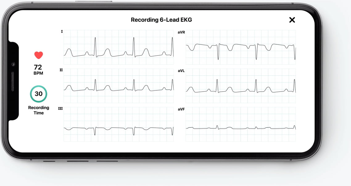 Credits: Alivecor