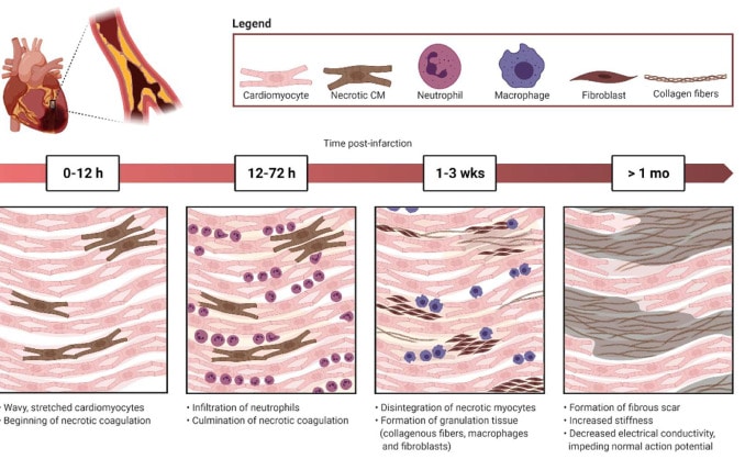 Rappresentazione schematica del processo di cicatrizzazione cui va incontro il tessuto cardiaco colpito da infarto miocardico. Credits: Morsink, Margaretha, et al. "Effects of electrically conductive nano-biomaterials on regulating cardiomyocyte behavior 