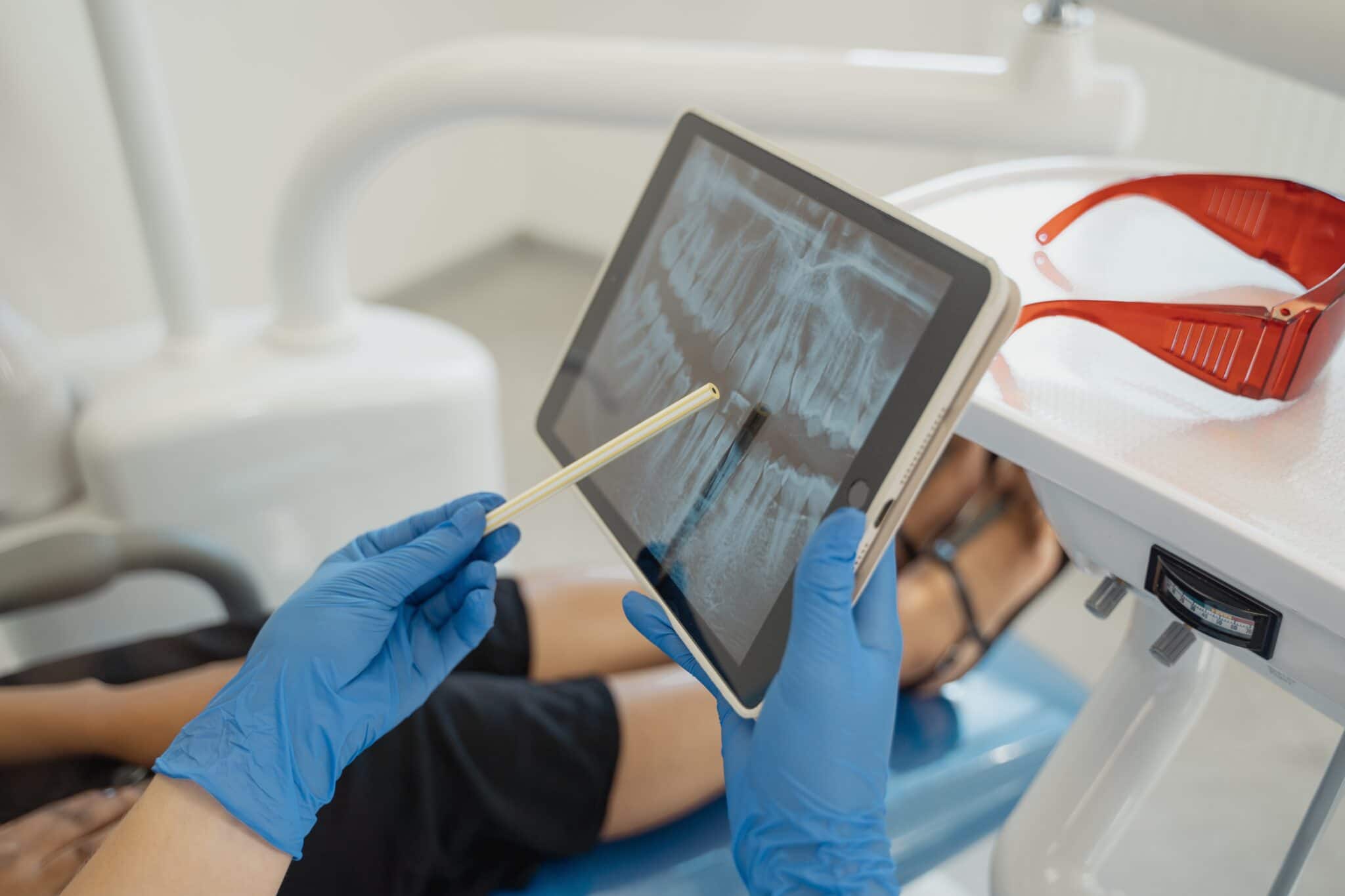 La rivoluzione digitale in radiologia: la pellicola radiografica è solo un ricordo