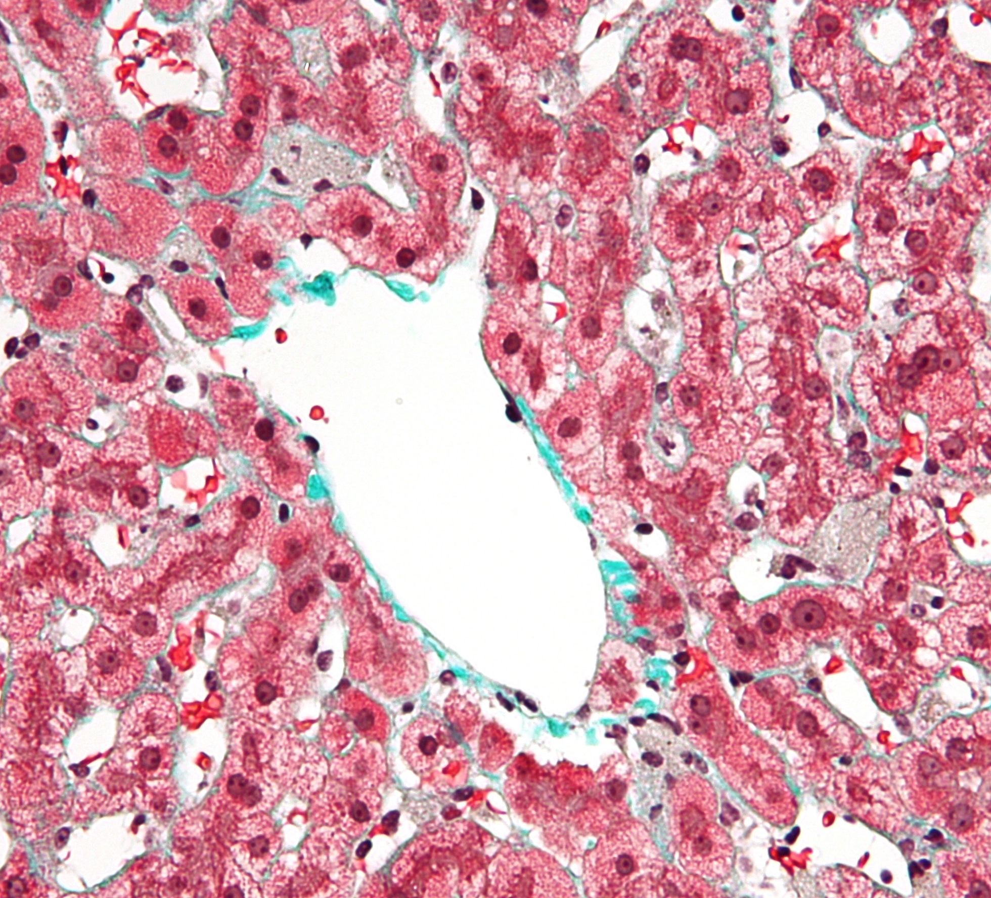 Cellule di Kupffer - Credits: Wikipedia