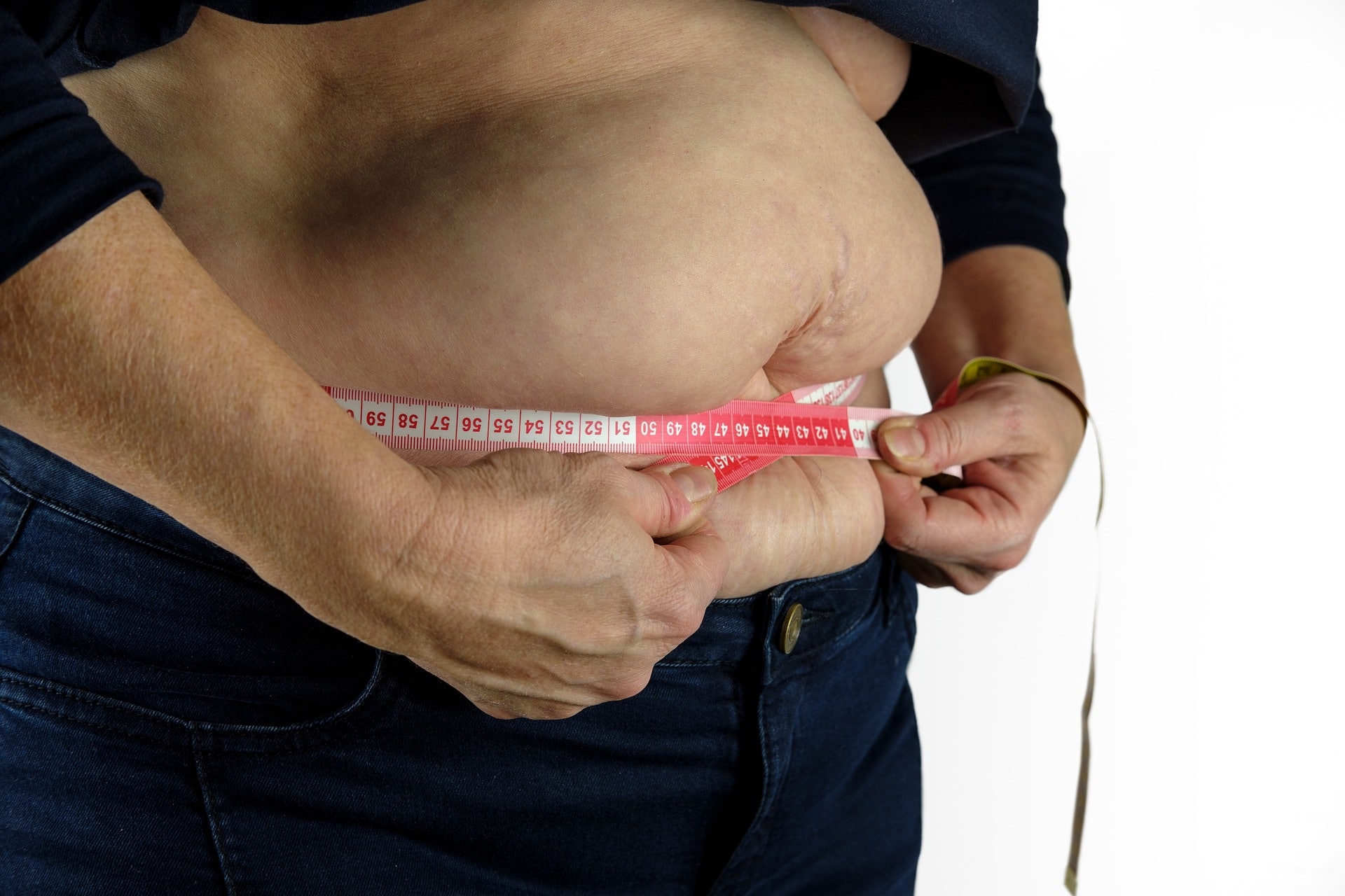 Chirurgia bariatrica: utilizzo di una clip innovativa per ridurre lo stomaco