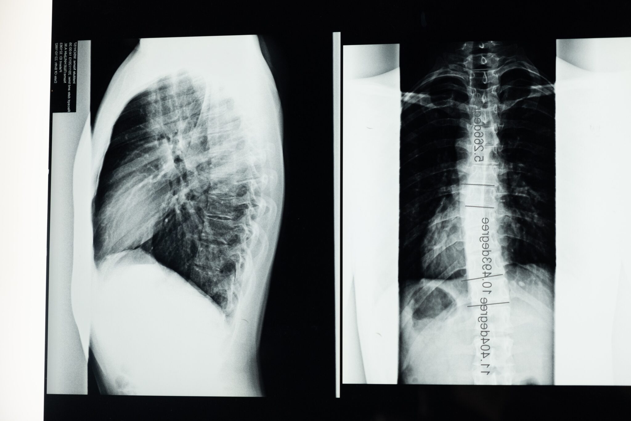 radiografia pellicola radiografica