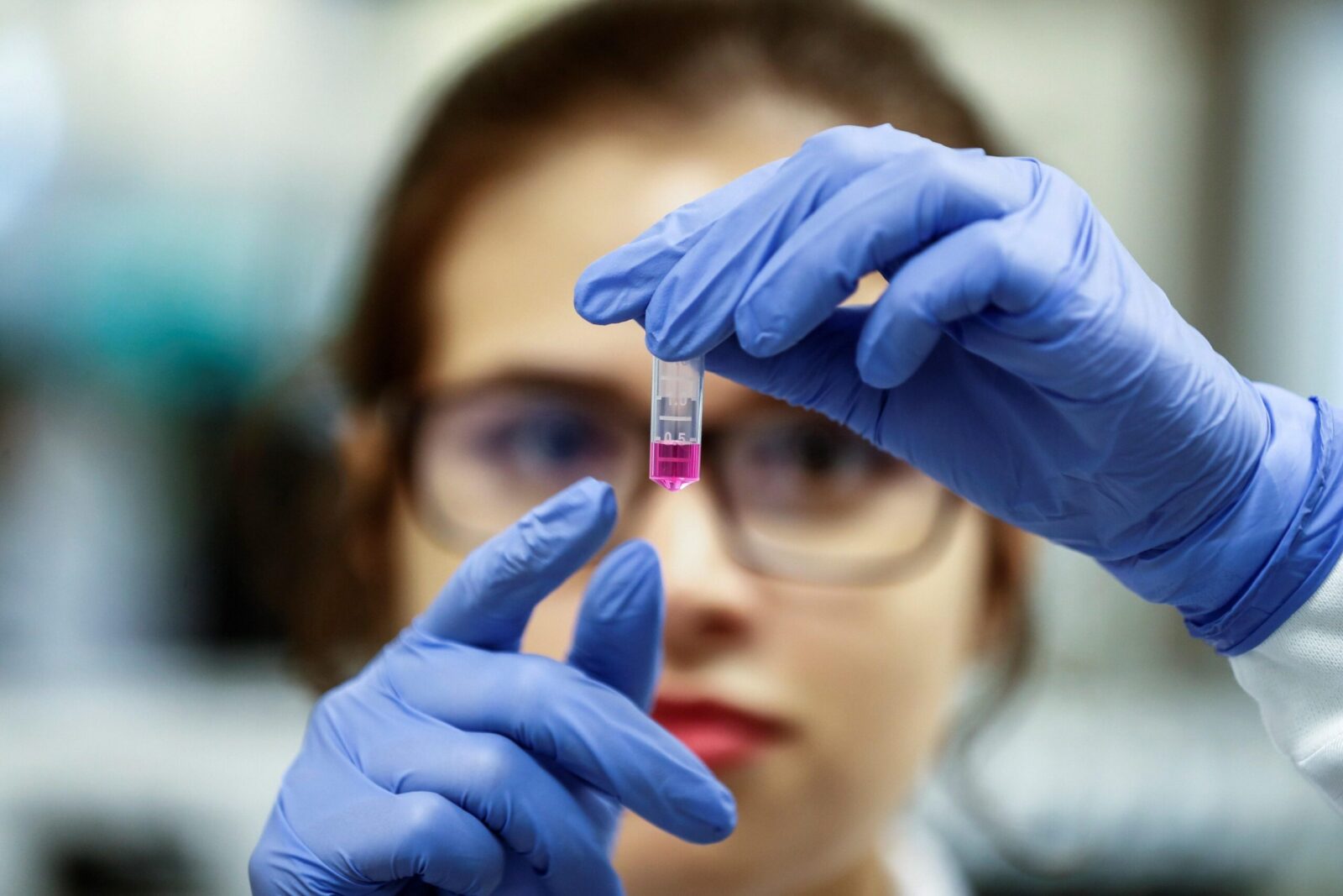 Anticorpi monoclonali: utili come profilassi contro il virus Covid-19
