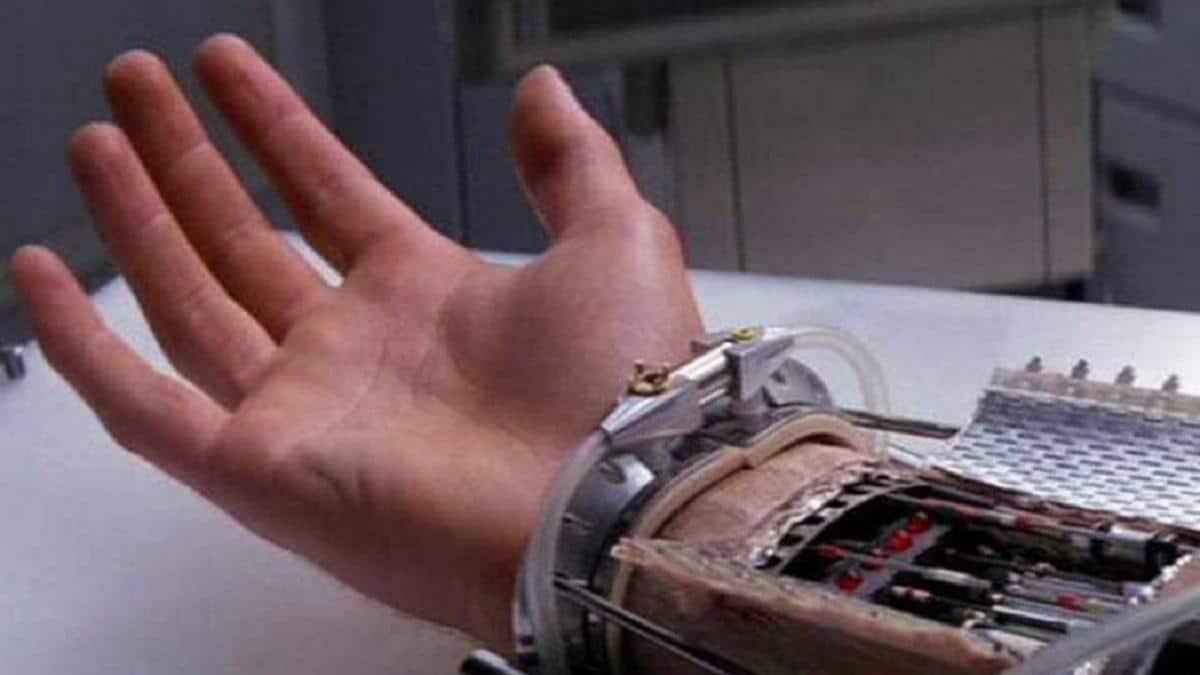 Trapianto di mano: la protesi bionica nuovo gold-standard? - Credits: Blasting News