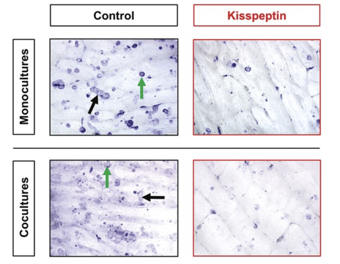 Immagini al microscopio che mostrano gli effetti inibitori della kisspeptina (10 nM) - Credits: The Journal of Clinican Endocrinology & Metabolism